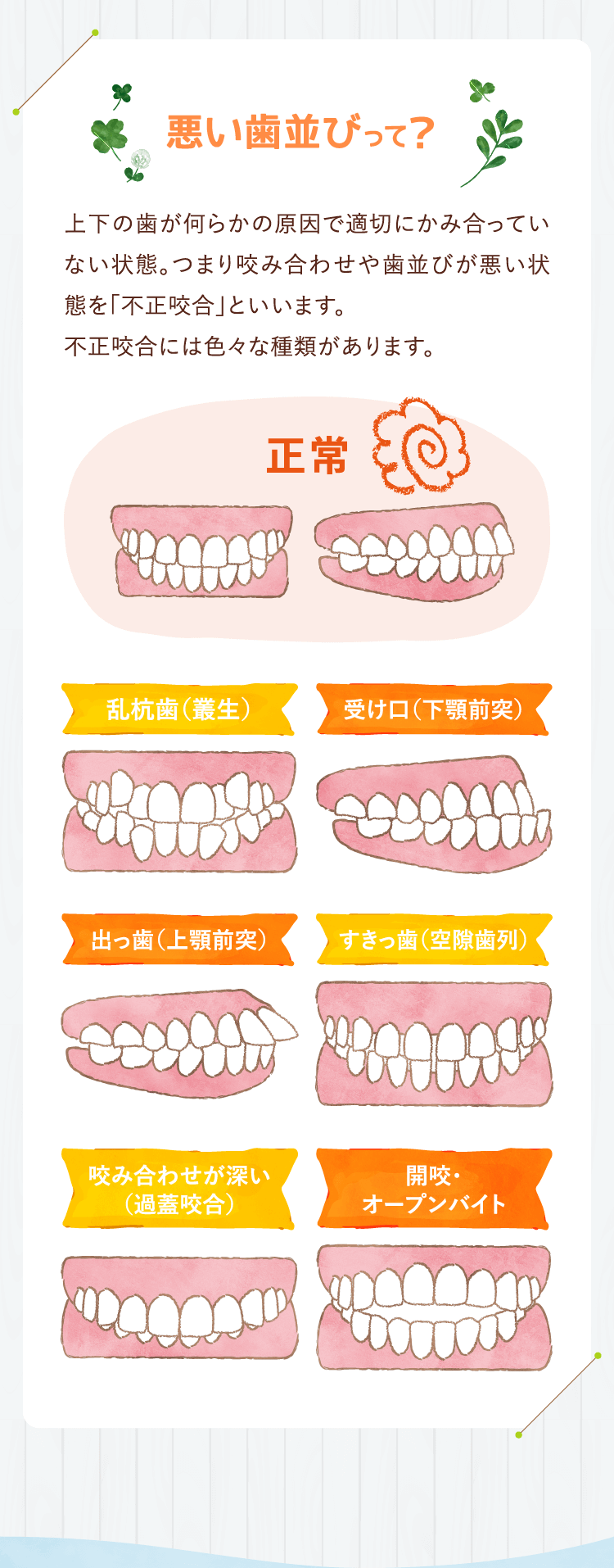 悪い歯並びって？